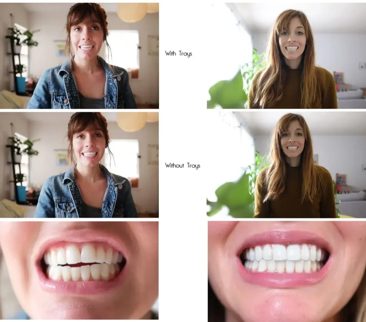 Invisalign® clear aligners