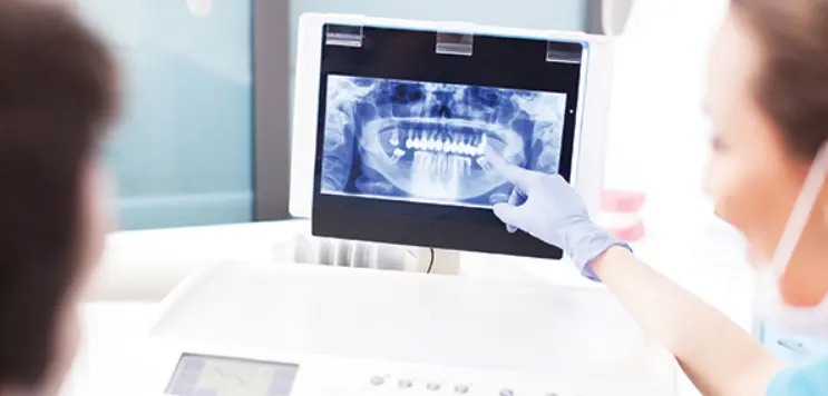 Digital X-ray at Bellevue Family Dentistry