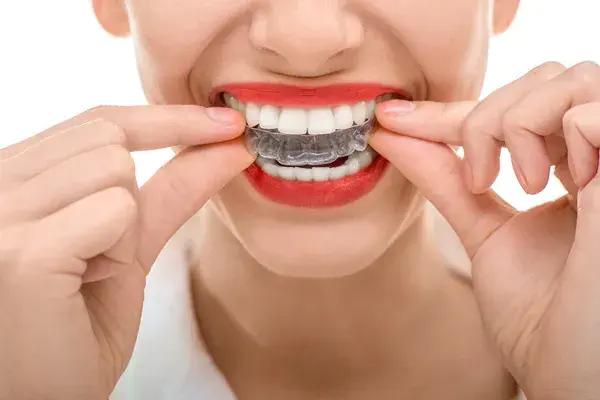 Oral Appliances