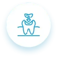 Tooth Extractions & Preservation