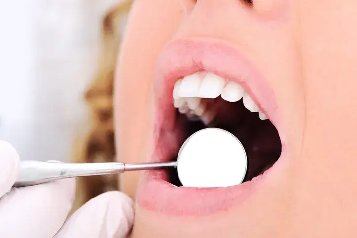 Why choose Bellevue Family Dentistry?
