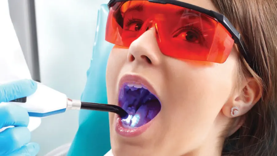 Sealants For Children